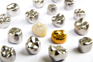 a pictured assortment of dental crowns made from various materials to illustrate comparing dental crowns and pros and cons of each material.