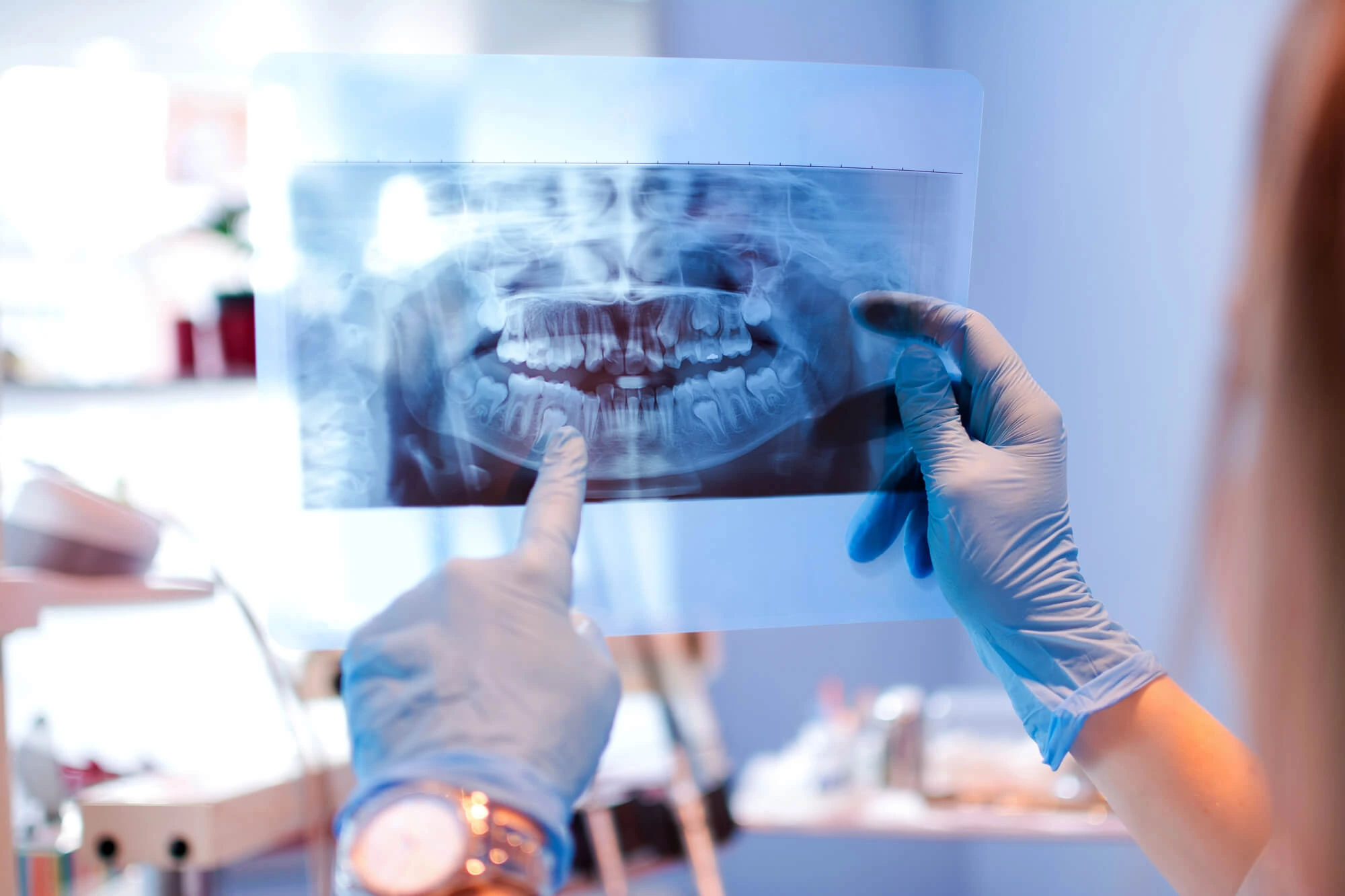 Preparation for Dental Implants in NC