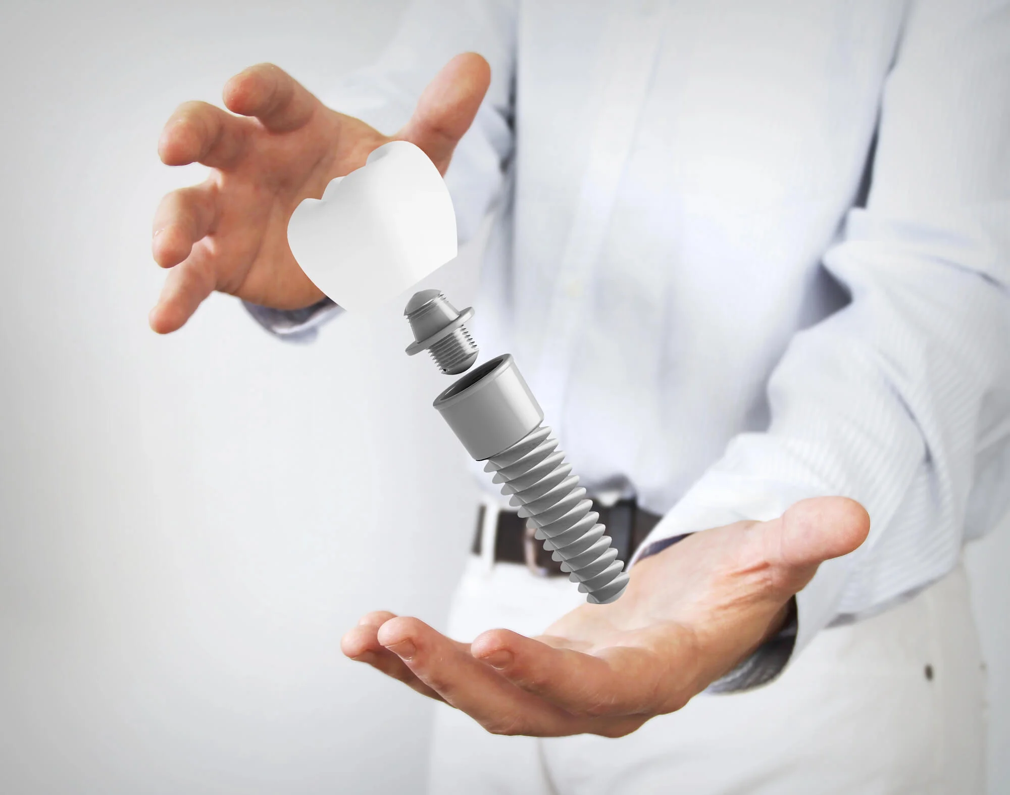 Dental implant restoration, best prosthodontist in Triangle area