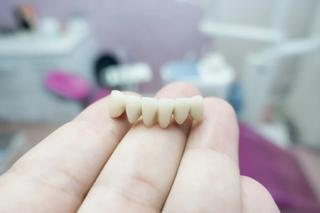 bridges missing teeth solutions durham